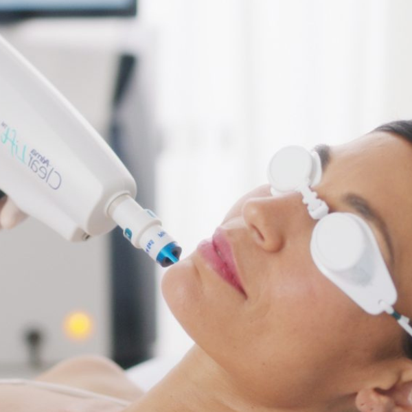Laser Skin Therapy(Unleash The New You (3)